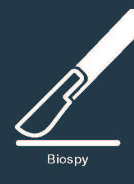 Biopsy
