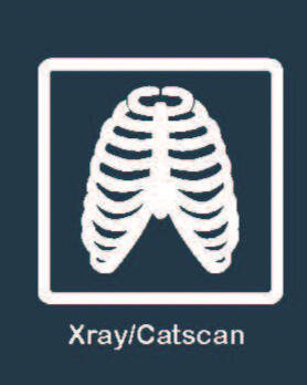 Xray/Catscan