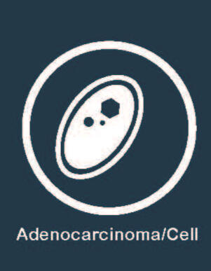 Adenocarcinoma cell